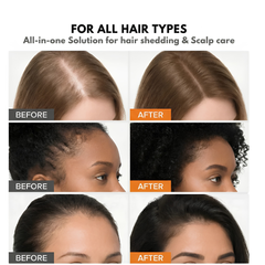 Hairderm Growth Serum