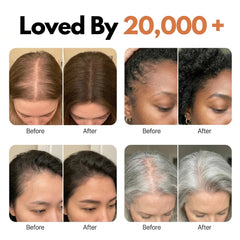 Hairderm Growth Serum